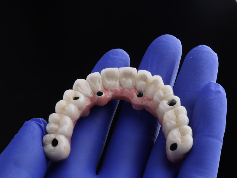 Navigating the World of Surgery Dental in Webster, TX